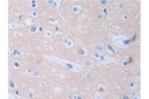 DAB staining on IHC-P; Samples: Human Cerebrum Tissue (Protein Phosphatase 3, Regulatory Subunit 1 (AA 2-170) Antikörper)