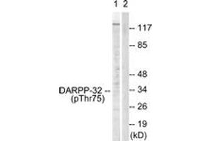 Western blot analysis of extracts from COS7 cells treated with Forskolin 40nM 30', using DARPP-32 (Phospho-Thr75) Antibody.
