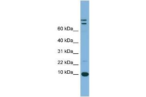 WB Suggested Anti-TFF1 Antibody Titration:  0. (TFF1 Antikörper  (Middle Region))