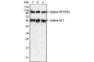 Western Blot showing PEG10 antibody used against HepG2 (1), SMMC-7721 (2) and A549 (3) cell lysate. (PEG10 Antikörper)