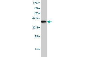 Western Blot detection against Immunogen (36. (TRIP6 Antikörper  (AA 51-148))