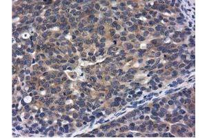 Immunohistochemical staining of paraffin-embedded Human Kidney tissue using anti-CBWD1 mouse monoclonal antibody. (CBWD1 Antikörper)