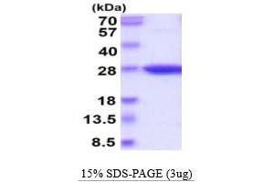 SDS-PAGE (SDS) image for Glutathione Peroxidase 3 (Plasma) (GPX3) (AA 21-226), (U73C) protein (His tag) (ABIN668027)
