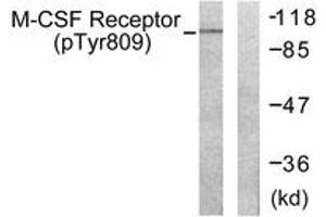 Western blot analysis of extracts from 293 cells treated with LPS 100ng/ml 30', using M-CSF Receptor (Phospho-Tyr809) Antibody.