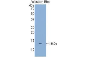 Western Blotting (WB) image for anti-Dickkopf 2 Homolog (DKK2) (AA 159-258) antibody (ABIN3207349) (DKK2 Antikörper  (AA 159-258))