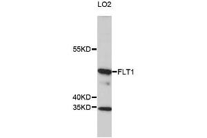 Western blot analysis of extracts of LO2 cells, using FLT1 antibody (ABIN5969988) at 1/1000 dilution. (FLT1 Antikörper)