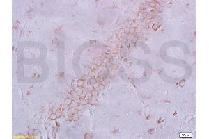 Frozen section rat brain labeled with Anti-NeuN Polyclonal Antibody, Unconjugated (ABIN732068) at 1:200 followed by conjugation to the secondary antibody and DAB staining