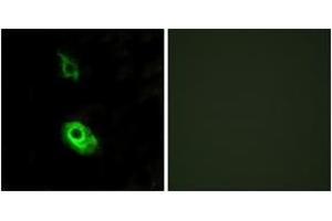 Immunofluorescence analysis of HeLa cells, using EDG3 Antibody.