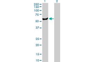 Western Blot analysis of UMPS expression in transfected 293T cell line by UMPS MaxPab polyclonal antibody. (UMPS Antikörper  (AA 1-480))