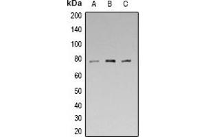 Western blot analysis of Synapsin 1 (pS553) expression in HEK293T (A), mouse brain (B), rat brain (C) whole cell lysates. (SYN1 Antikörper  (pSer553))