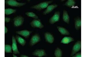 Immunofluorescence (IF) image for anti-Core-binding Factor, Runt Domain, alpha Subunit 2, Translocated To, 2 (CBFA2T2) antibody (ABIN930909)