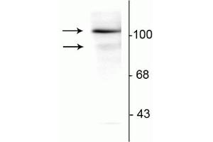 Western blot of T47D cell lysate prepared from cells that had been incubated in the presence of the synthetic progestin agonist R5020 (500 nM) showing specific immunolabeling of the ~90 kDa PR-A isoform and the ~120 kDa PR-B isoform of the progesterone receptor phosphorylated at Ser294. (Progesterone Receptor Antikörper  (pSer294))