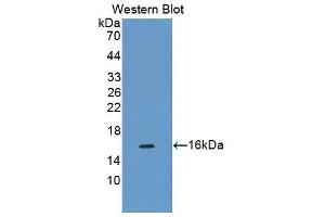 Figure. (CDK2AP1 Antikörper  (AA 1-115))