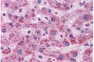 Human Liver: Formalin-Fixed, Paraffin-Embedded (FFPE) (Cyclin D1 Antikörper)