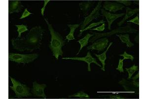 Immunofluorescence of monoclonal antibody to RPL32 on HeLa cell. (RPL32 Antikörper  (AA 33-132))