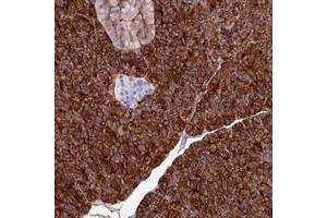 Immunohistochemical staining of human pancreas with ANO6 polyclonal antibody  shows strong cytoplasmic and membranous positivity in exocrine glandular cells at 1:500-1:1000 dilution. (Anoctamin 6 Antikörper)
