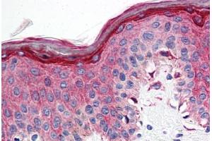 Anti-5HT1E Receptor antibody  ABIN1048261 IHC staining of human skin. (Serotonin Receptor 1E Antikörper  (Cytoplasmic Domain))