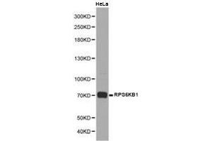 Western Blotting (WB) image for anti-Ribosomal Protein S6 Kinase, 70kDa, Polypeptide 1 (RPS6KB1) antibody (ABIN1874663)