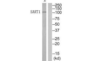 Western Blotting (WB) image for anti-Squamous Cell Carcinoma Antigen Recognized By T Cells (SART1) (Internal Region) antibody (ABIN1852322)