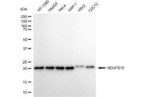 Western blotting analysis using NDUFB10 antibody (ABIN7799547).