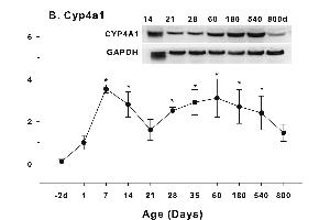 Age-related expression of CYP-4 family gene/proteins in livers of male rats.