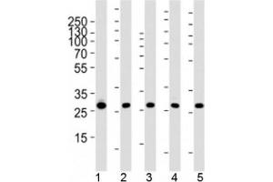 Western blot analysis of lysate from 1) 293, 2) MCF-7, 3) HepG2, 4) mouse NIH3T3 cell line and 5) rat liver tissue using PHB1 antibody at 1:1000. (Prohibitin Antikörper)