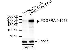 Western blot analysis of extracts of HepG2 cells, using Phospho-PDGFRA-Y1018 antibody. (PDGFRA Antikörper  (pTyr1018))