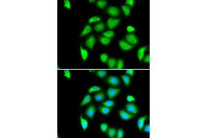 Immunofluorescence analysis of U20S cell using RPS5 antibody.