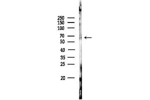 anti-AarF Domain Containing Kinase 5 (ADCK5) (N-Term) antibody