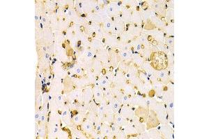 Immunohistochemistry (IHC) image for anti-Potassium Voltage-Gated Channel, Subfamily H (Eag-Related), Member 2 (KCNH2) antibody (ABIN3023436) (KCNH2 Antikörper)