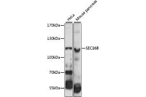 Western blot analysis of extracts of various cell lines, using SEC16B antibody (ABIN6292556) at 1:1000 dilution. (SEC16B Antikörper)