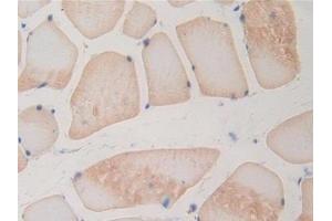 DAB staining on IHC-P; Samples: Rat Skeletal muscle Tissue