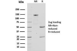 SDS-PAGE (SDS) image for anti-BCL2-Like 1 (BCL2L1) (AA 1-135) antibody (ABIN6940515)