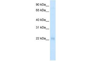WB Suggested Anti-CSRP3 Antibody   Titration: 2. (CSRP3 Antikörper  (Middle Region))