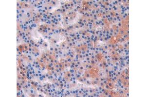 IHC-P analysis of adrenal gland tissue, with DAB staining. (IL-17 Antikörper  (AA 18-150))