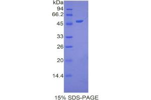 SDS-PAGE analysis of Human Apolipoprotein A5 Protein. (APOA5 Protein)