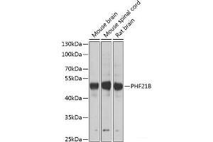 Western blot analysis of extracts of various cell lines using PHF21B Polyclonal Antibody at dilution of 1:1000. (PHF21B Antikörper)