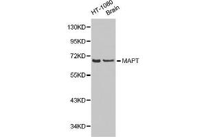 Western Blotting (WB) image for anti-Microtubule-Associated Protein tau (MAPT) (AA 1-100) antibody (ABIN6215045) (MAPT Antikörper  (AA 1-100))
