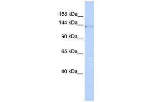 WB Suggested Anti-ZNF445 Antibody Titration:  0. (ZNF445 Antikörper  (Middle Region))
