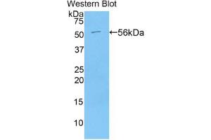 Western blot analysis of the recombinant protein. (Angiotensin I Converting Enzyme 1 Antikörper  (AA 504-597))