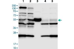 Western blot analysis of Lane 1: RT-4, Lane 2: U-251 MG, Lane 3: Human Plasma, Lane 4: Liver, Lane 5: Tonsil with C11orf84 polyclonal antibody . (C11ORF84 Antikörper)
