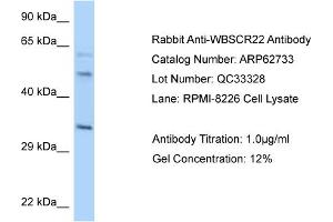 Western Blotting (WB) image for anti-Williams Beuren Syndrome Chromosome Region 22 (WBSCR22) (C-Term) antibody (ABIN2789229)