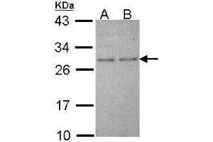 WB Image Sample (30 ug of whole cell lysate) A: Molt-4 , B: Raji 12% SDS PAGE antibody diluted at 1:1000 (HPRT1 Antikörper)