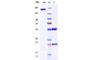 Anti-CCR5 / CD195 Reference Antibody (leronlimab) on SDS-PAGE under reducing (R) condition.