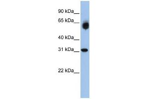 WB Suggested Anti-DHRS2 Antibody Titration:  0. (DHRS2 Antikörper  (Middle Region))
