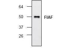 Image no. 1 for anti-Angiopoietin-Like 4 (ANGPTL4) antibody (ABIN127156) (ANGPTL4 Antikörper)