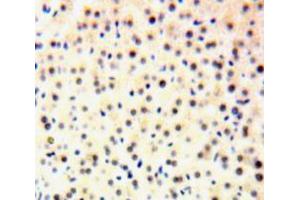 IHC-P analysis of Liver tissue, with DAB staining. (GTF2H1 Antikörper  (AA 84-335))