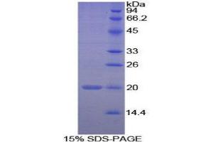 SDS-PAGE (SDS) image for Peptidylprolyl Isomerase F (PPIF) (AA 45-196) protein (His tag) (ABIN1879609)