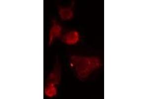 ABIN6275531 staining  HepG2 cells by IF/ICC. (NEK7 Antikörper  (Internal Region))