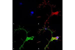 Immunocytochemistry/Immunofluorescence analysis using Mouse Anti-GABA-B Receptor 1 Monoclonal Antibody, Clone S93A-49 (ABIN2484093). (GABBR1 Antikörper  (AA 873-977) (Atto 594))